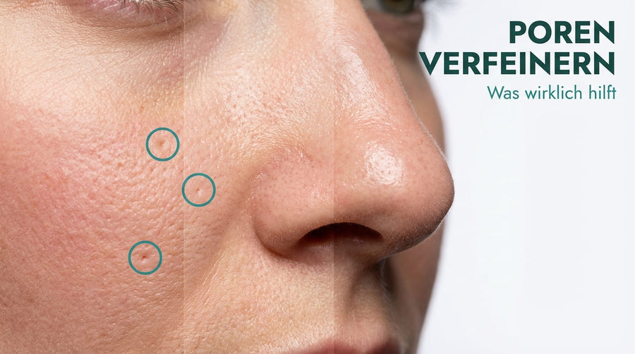 Große Poren verfeinern: Was wirklich hilft | AMPURA®