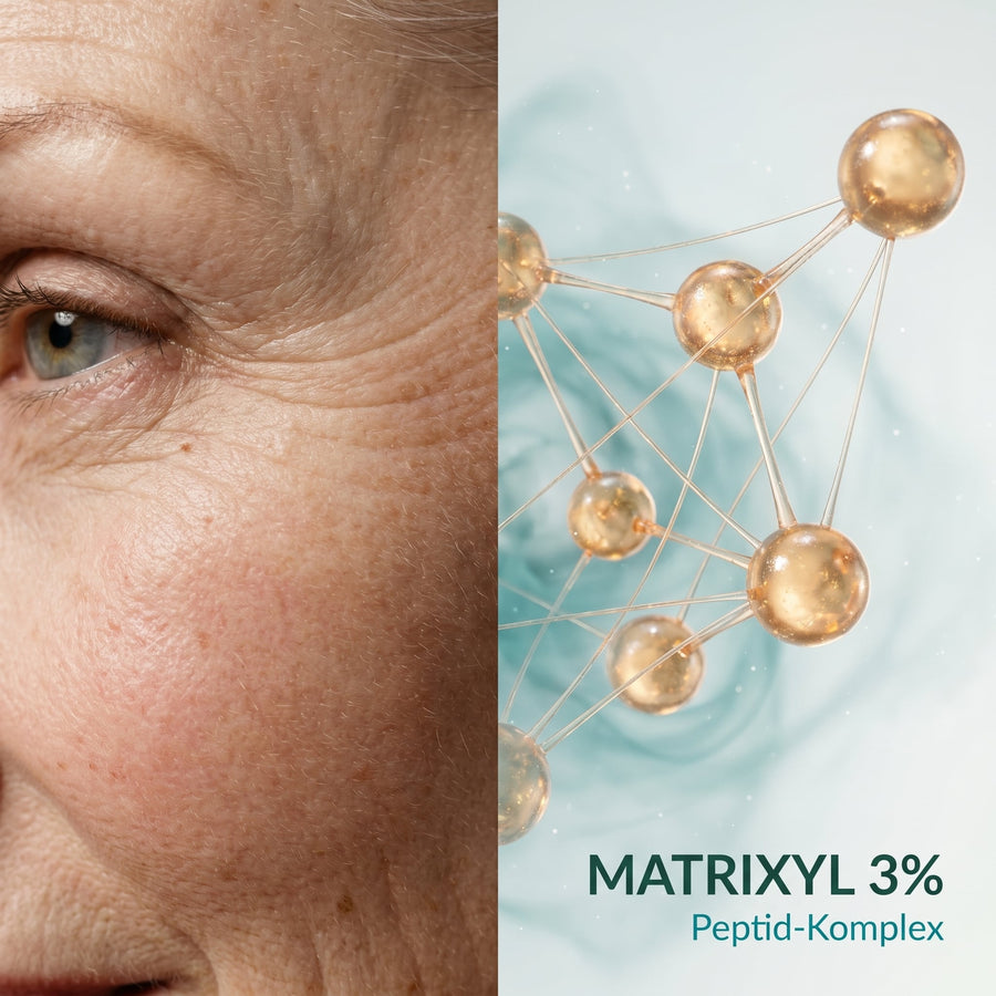 Pigmentflecken entfernen: Hausmittel, Laser oder Microneedling?