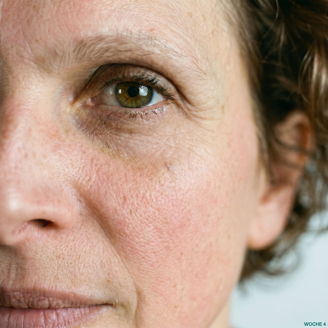 Microneedling wie oft Anwendungsfrequenz