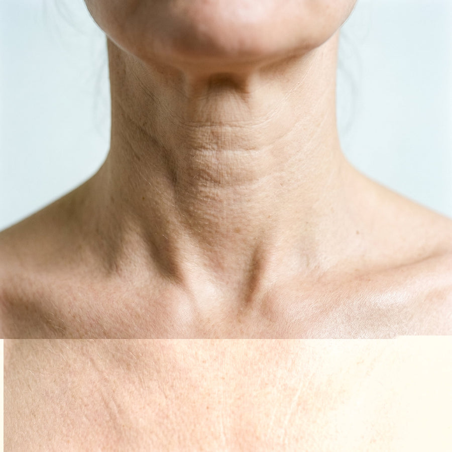 Microneedling Hals & Dekolleté: Anwendung und Vorher-Nachher