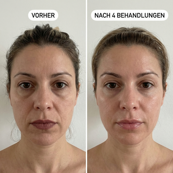 Falten rund um den Mund