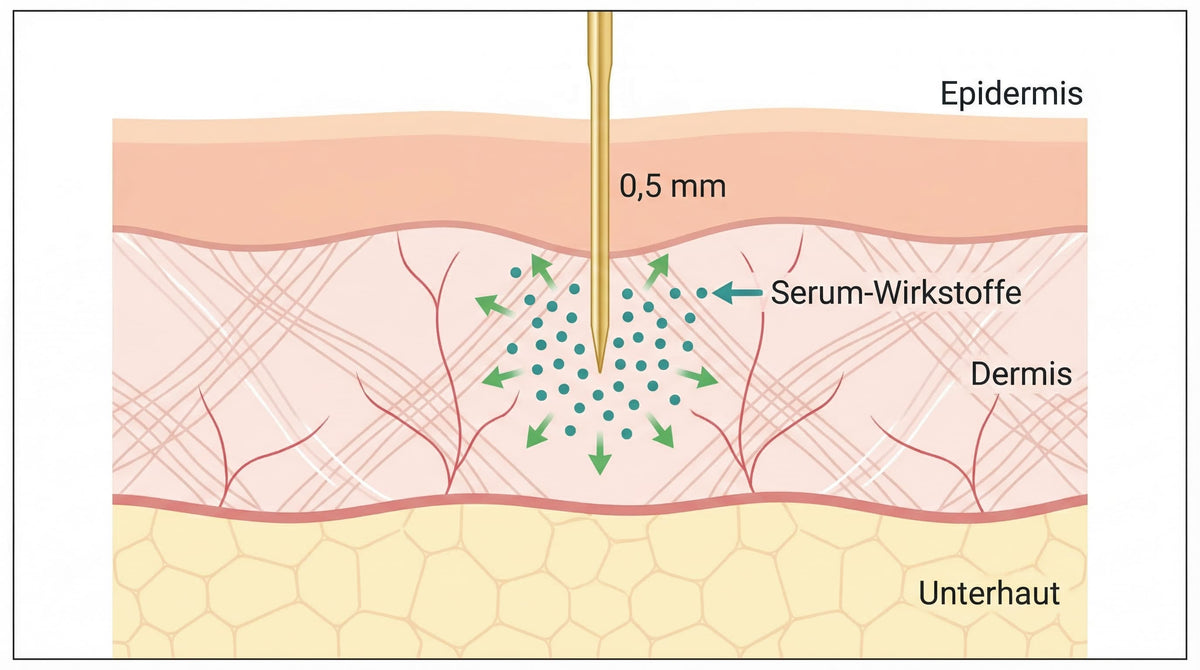 Querschnitt der Hautschichten zeigt wie Microneedling-Nadel Serum-Wirkstoffe in die Dermis schleust
